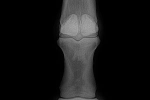 Dog Leg x-ray